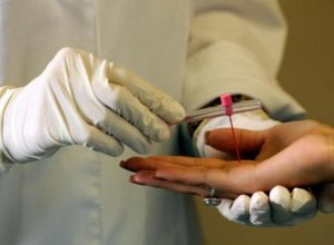 ses-reforca-acoes-para-enfrentar-a-hanseniase-em-mato-grosso